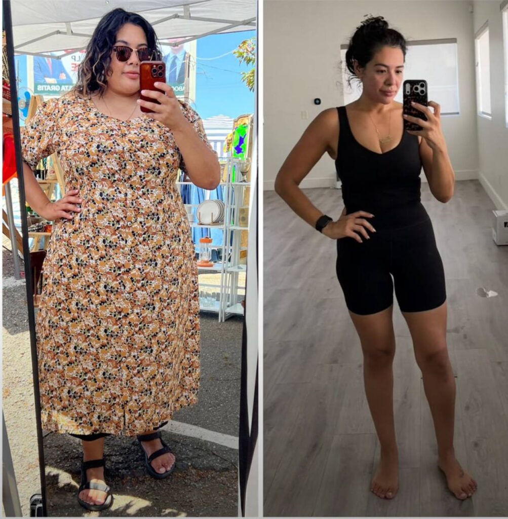 weight loss injections